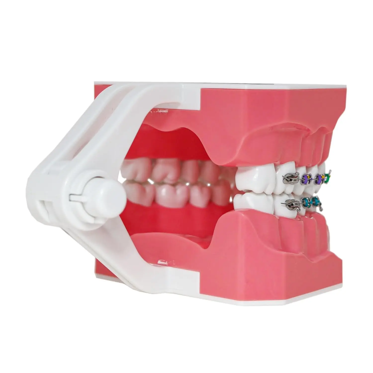 This dental orthodontic model demonstrates teeth with braces, wires, and elastics, ideal for teaching and explaining orthodontic concepts.