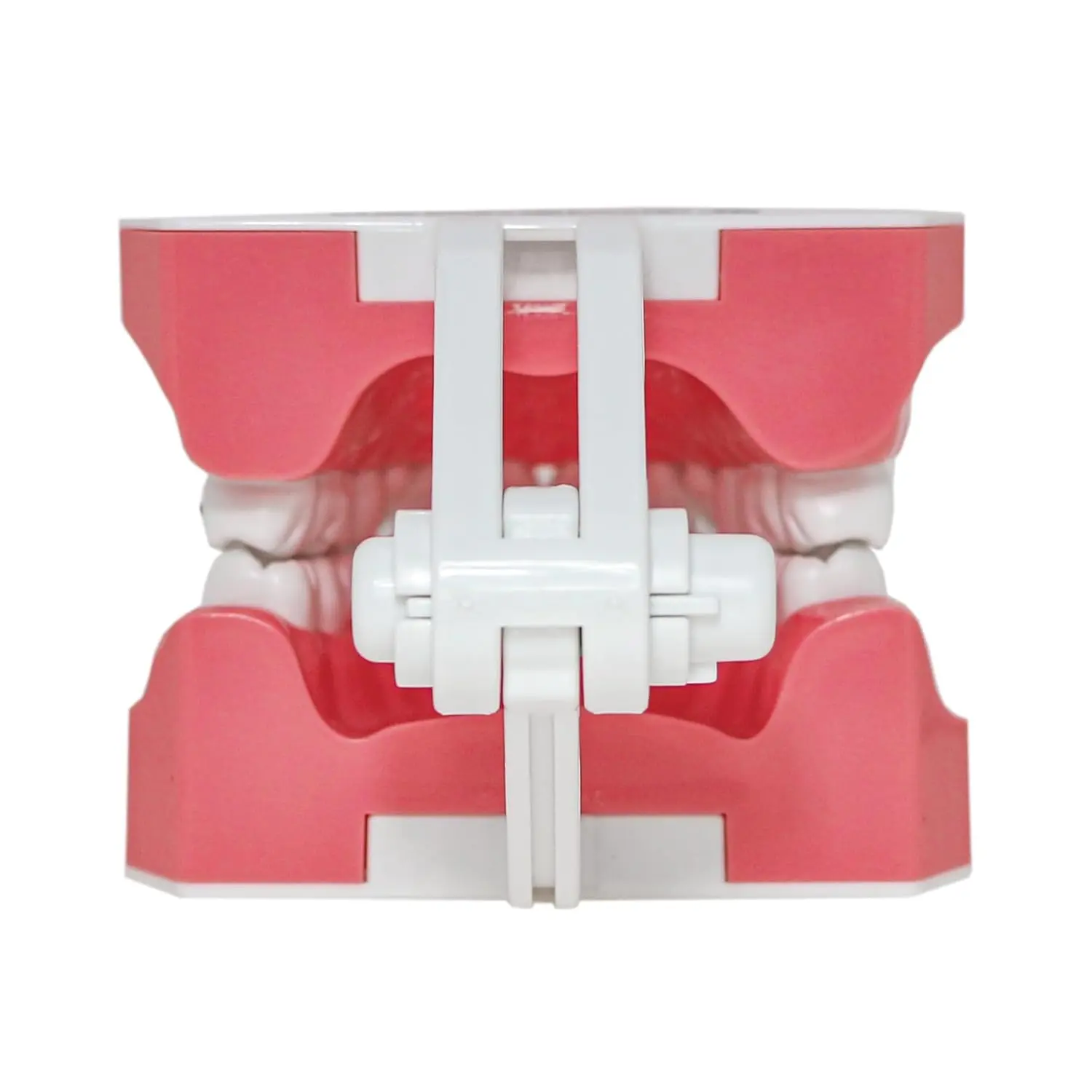 This dental orthodontic model demonstrates teeth with braces, wires, and elastics, ideal for teaching and explaining orthodontic concepts.