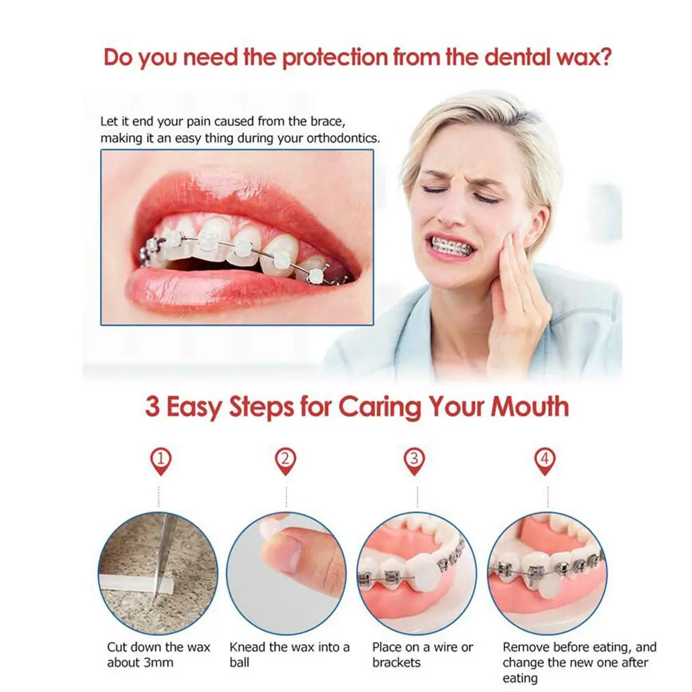 Ten boxes of Angzhili orthodontic wax for braces wearers provide relief from irritation caused by brackets and wires, ensuring perfect oral care and fresh breath with multiple scents.