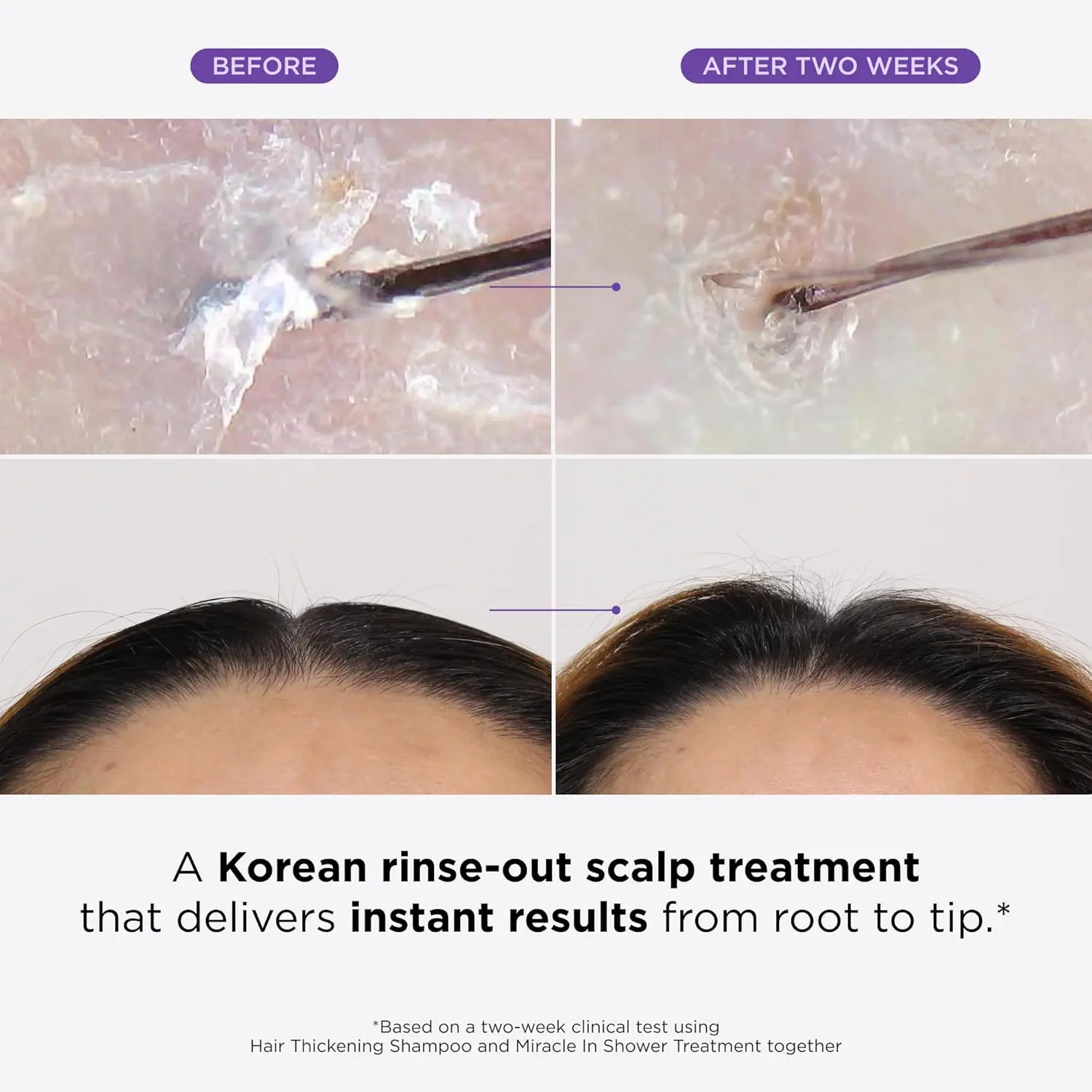 Dr. Groot miracle in-shower treatment visibly thickens hair, reduces hair loss due to breakage, exfoliates and moisturizes the scalp for healthier hair.