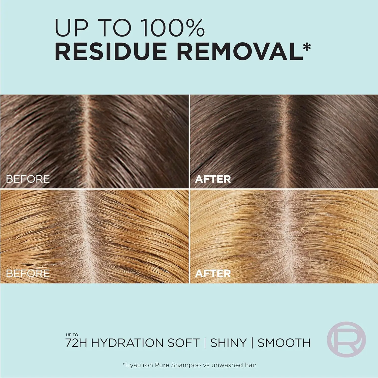 L'Oreal Paris Elvive Hyaluron + Pure Oil Erasing Scalp Serum exfoliates and removes residue, leaving oily hair refreshed and hydrated for up to 72 hours.