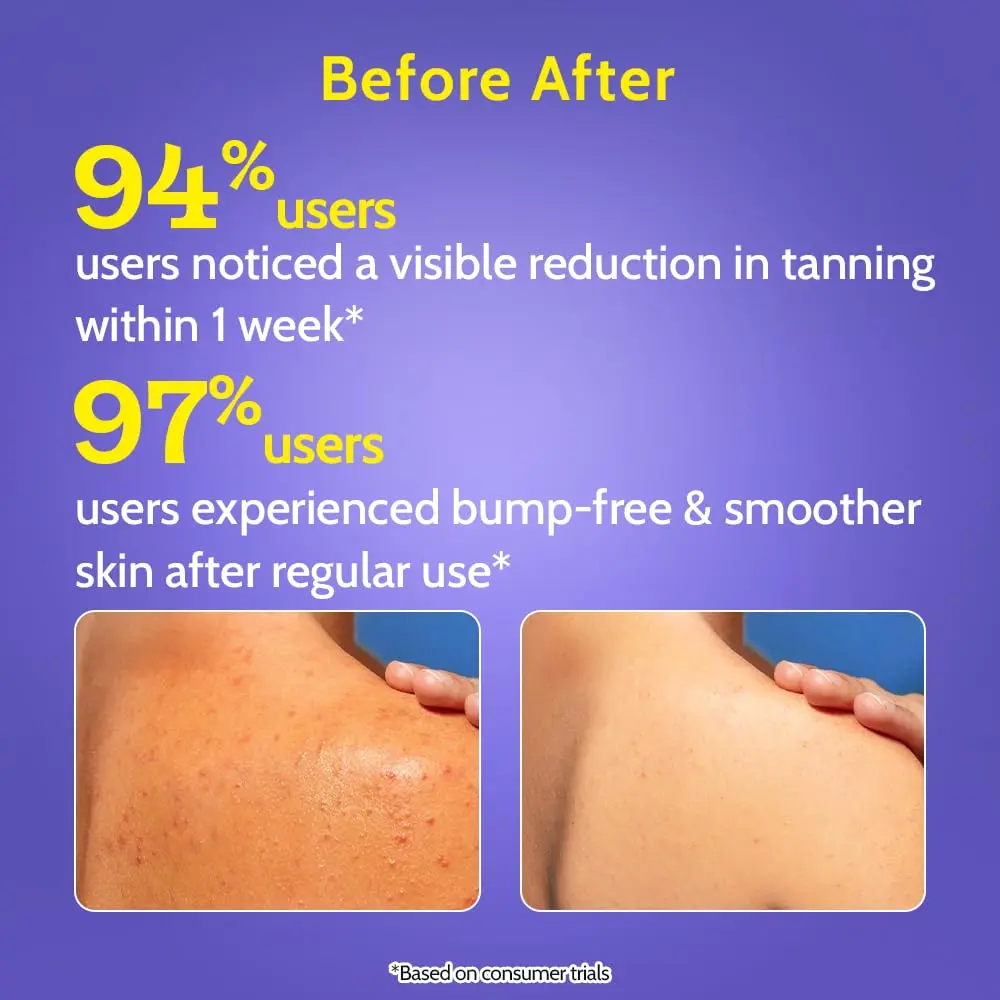 Chemist at Play exfoliating body wash with lactic acid gently exfoliates rough and bumpy skin, revealing smoother, softer skin and even skin tone.