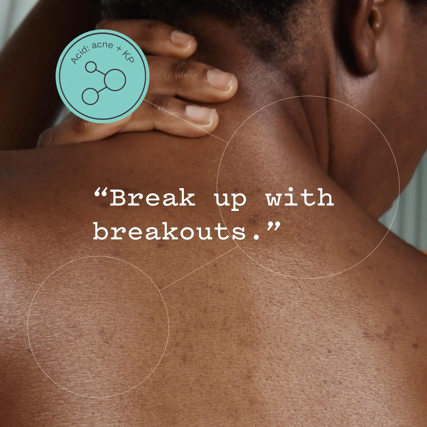 Frank Body glycolic body scrub exfoliates and smooths skin with AHAs, pumice, witch hazel, and niacinamide, helping to reduce breakouts, ingrown hairs, and uneven texture.