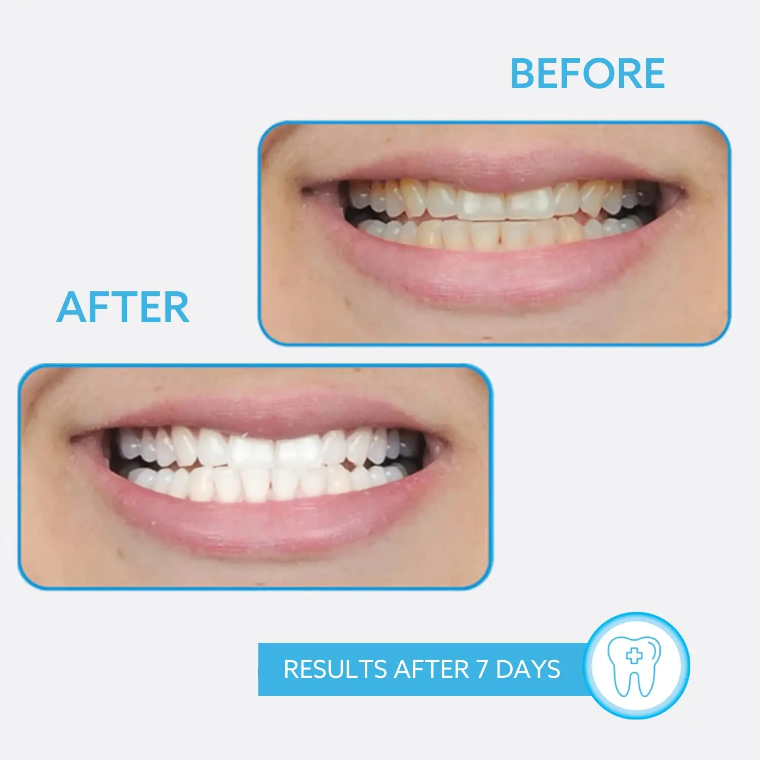 This image shows the GO Smile On The Go Teeth Whitening Pen 2 Pack, a convenient and portable way to whiten your teeth anytime, anywhere, for a brighter smile.