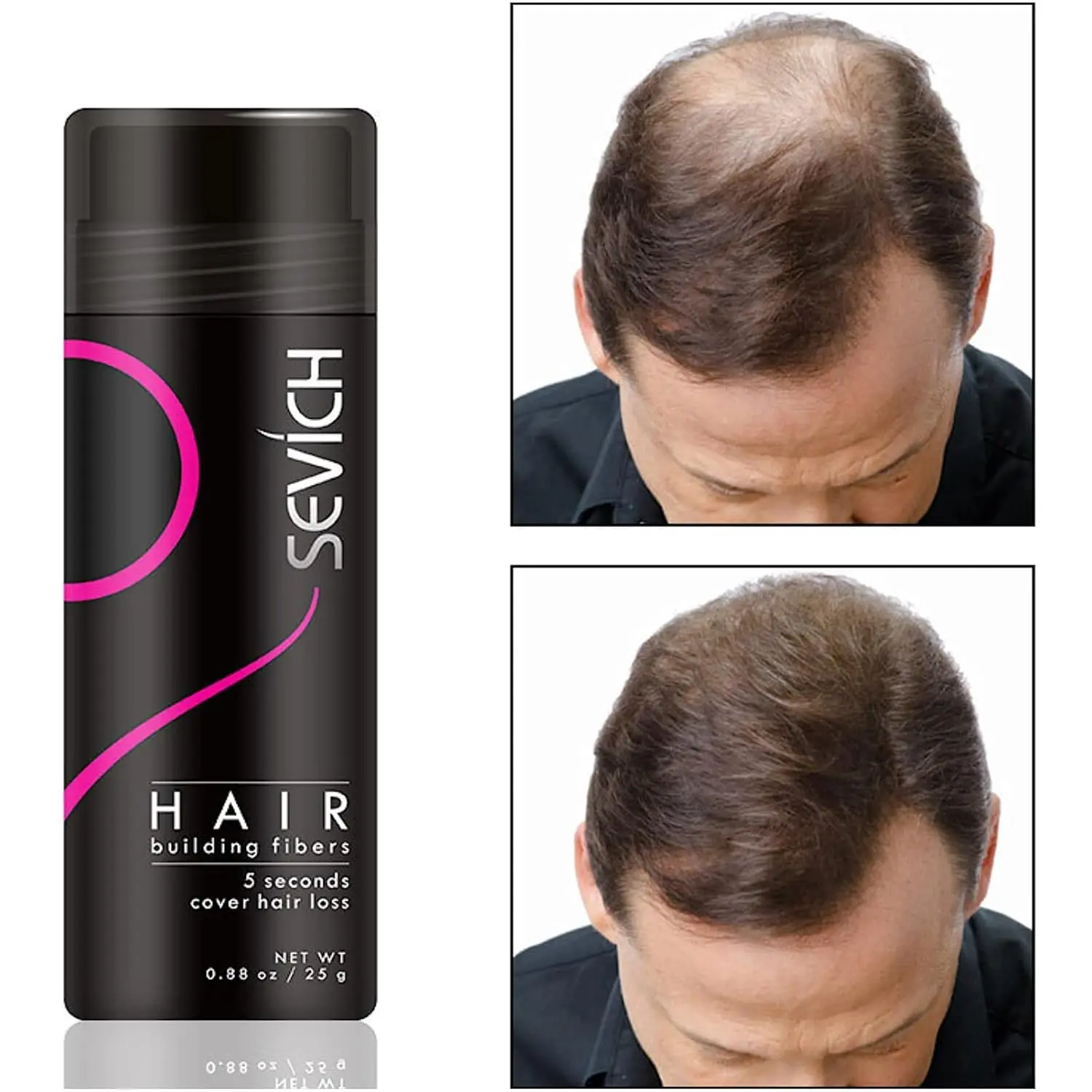 Dark brown hair fiber instantly conceals hair loss and thinning areas, providing a fuller, natural-looking head of hair for men and women.