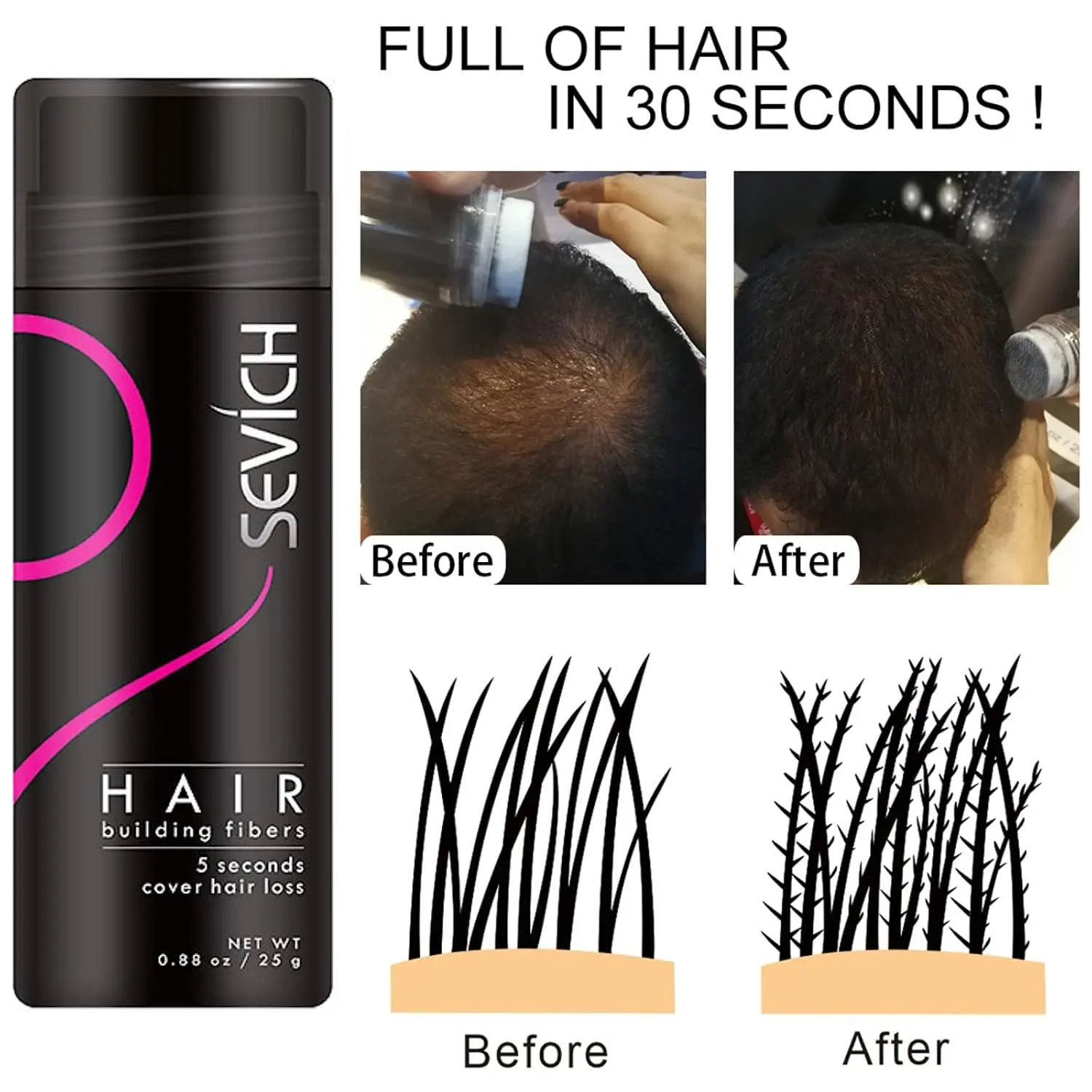 Dark brown hair fiber instantly conceals hair loss and thinning areas, providing a fuller, natural-looking head of hair for men and women.