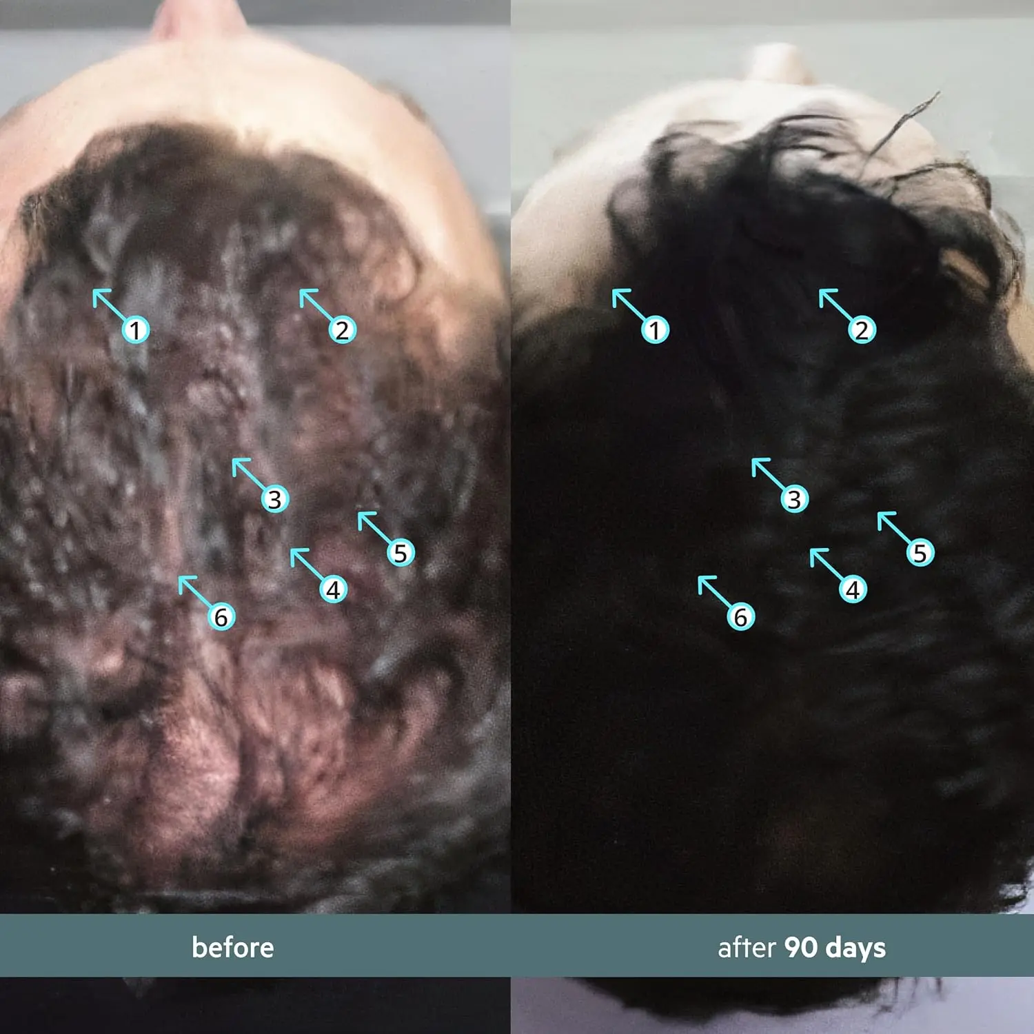 Spectral F7 hair growth serum for men and women, a booster to combat stress-induced hair loss and improve scalp health.