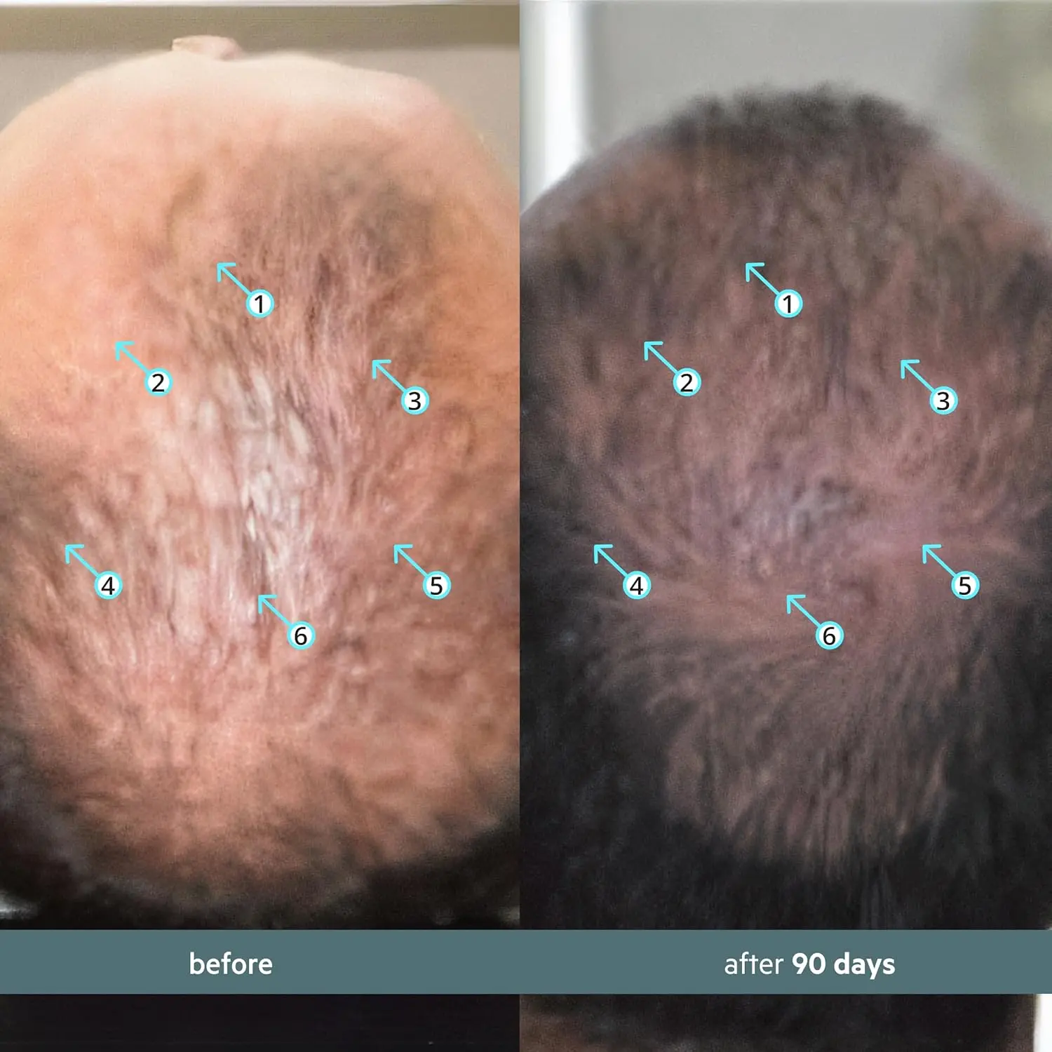 Spectral F7 hair growth serum for men and women, a booster to combat stress-induced hair loss and improve scalp health.