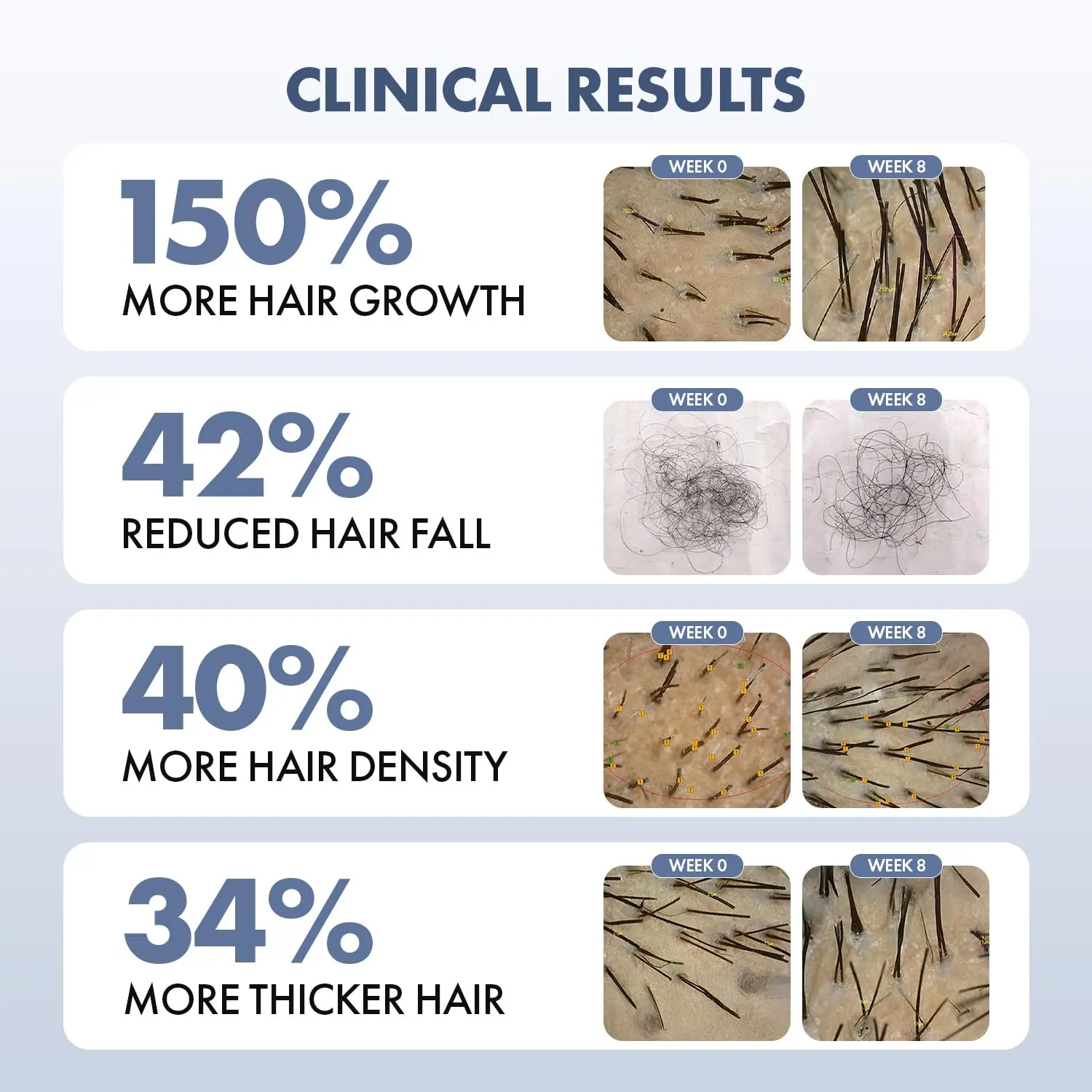 ThriveCo hair growth serum featuring Redensyl, Anagain, and Procapil to fight hair loss and promote hair density for both men and women, suitable for all hair types.