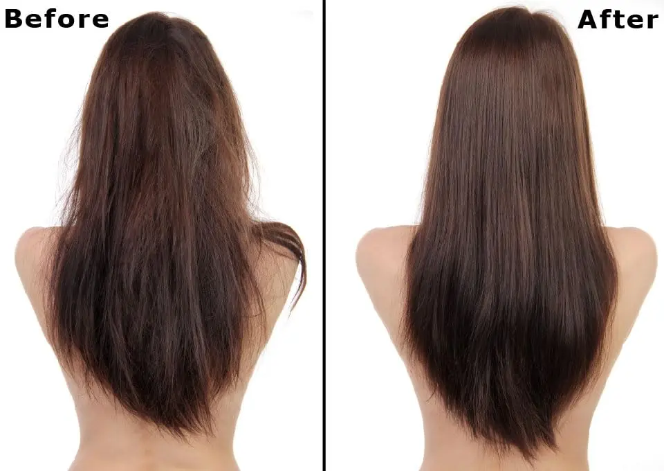 This image shows a hair and scalp treatment set of shampoo and conditioner that helps with dandruff, oil control, anti-aging, and itching, promoting hair regrowth.