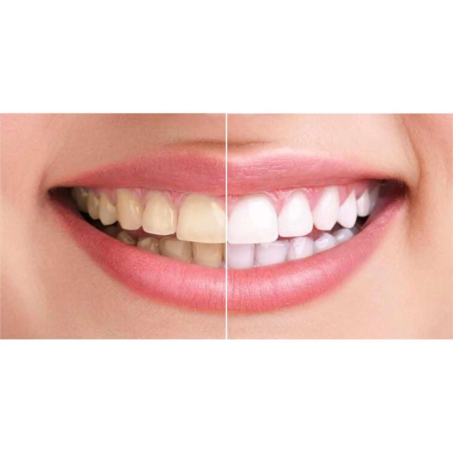 King Mariot Medical Equipments hydrogen peroxide solution available in 3%, 6%, 12%, and 30% concentrations for teeth whitening, mild disinfection, and acne scar treatment.