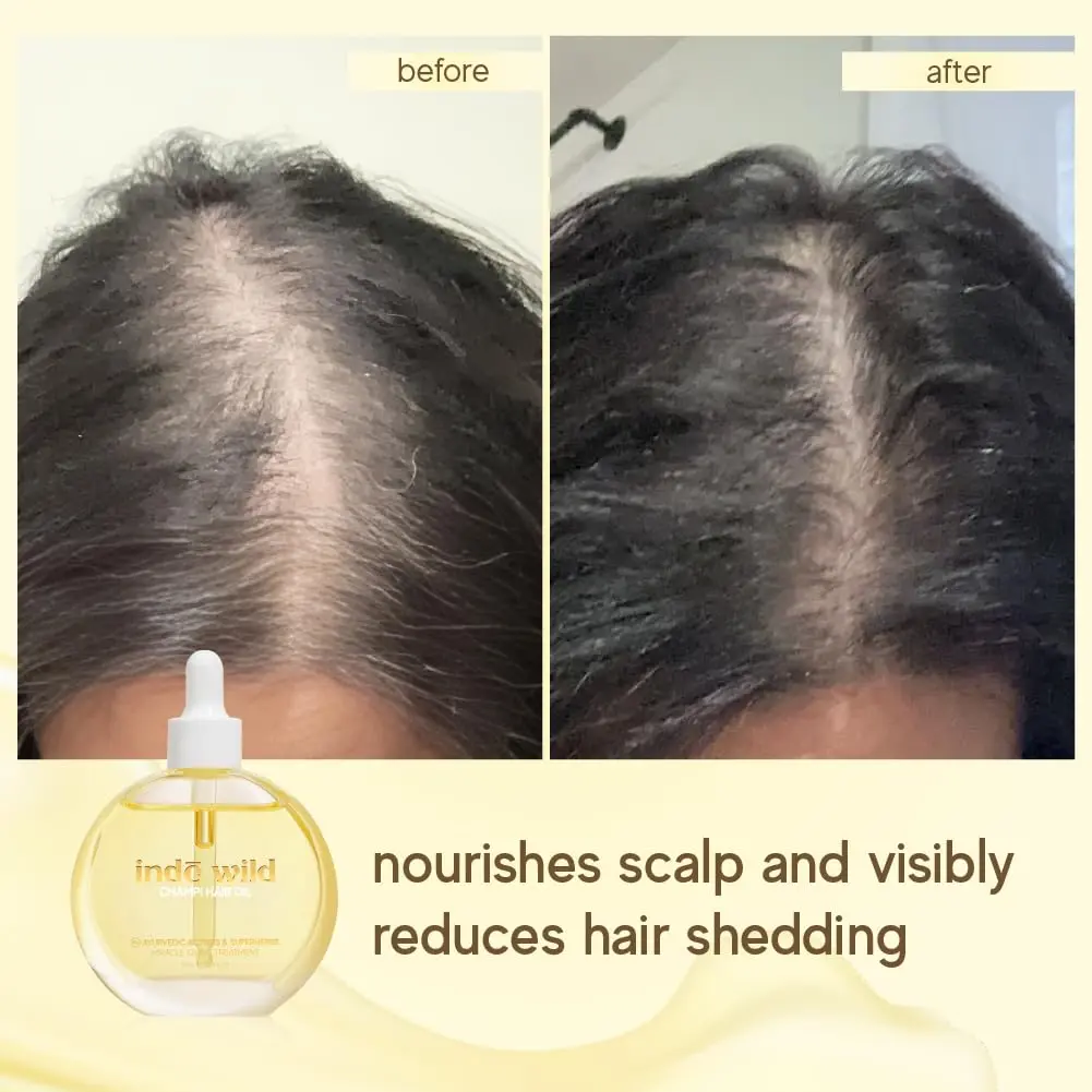 inde wild hair oil infused with Ayurvedic ingredients like Bhringraj, Brahmi, and Amla to strengthen hair, soothe the scalp, and promote healthy growth.