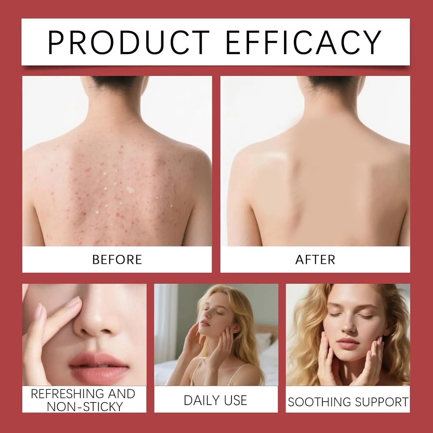 This keratosis pilaris treatment cream is designed to hydrate, exfoliate and moisturize dry, rough skin, visibly improving the appearance of strawberry legs and skin blemishes.