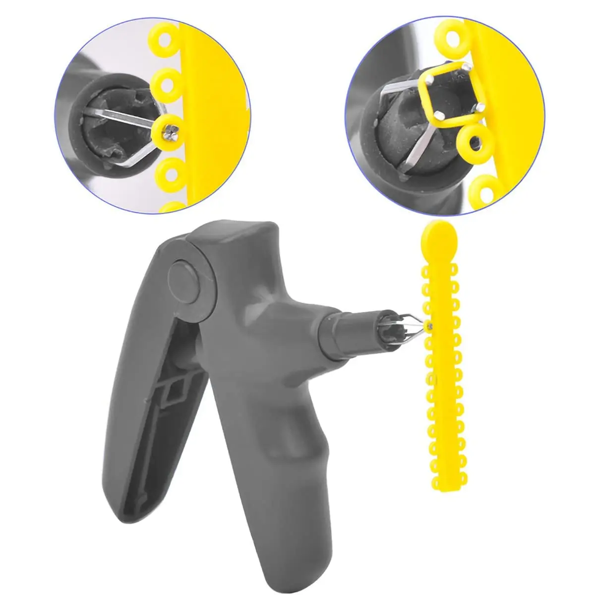 This set features a ligature tie gun with a non-slip handle and a pack of 1040 multi-colored dental orthodontic ligature ties made of hypoallergenic, elastic material for dental accessories.