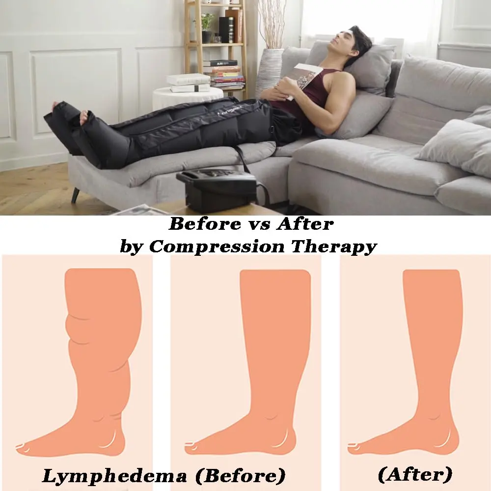 This lymphedema leg compression recovery system provides air compression to reduce swelling and pain while improving circulation.