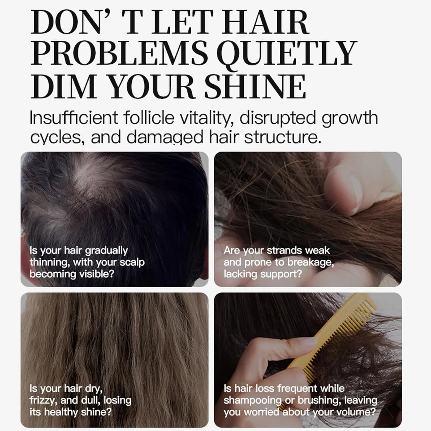 Two bottles of 5% minoxidil spray for men and women to help prevent hair thinning, stimulate hair follicles, and promote hair regrowth for thicker, fuller hair.