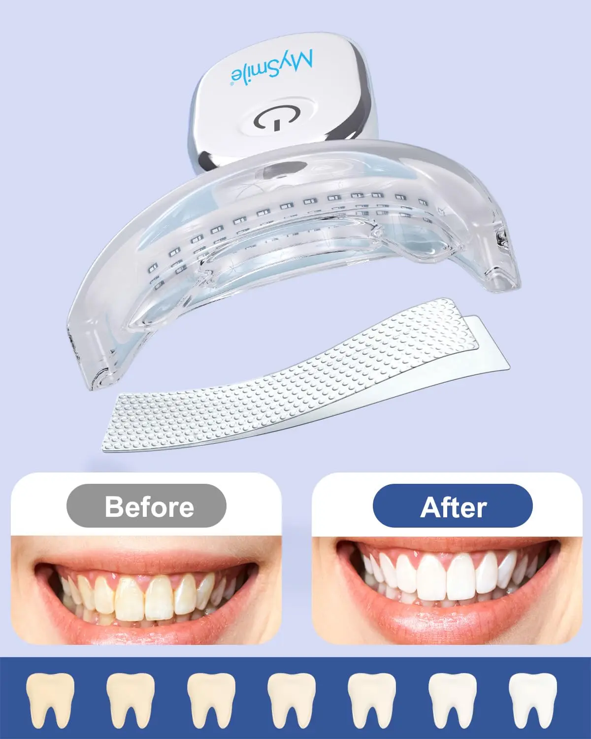 MySmile teeth whitening kit with LED light and whitening strips for sensitive teeth delivers a brighter, whiter smile in just 10 minutes at home or on the go.