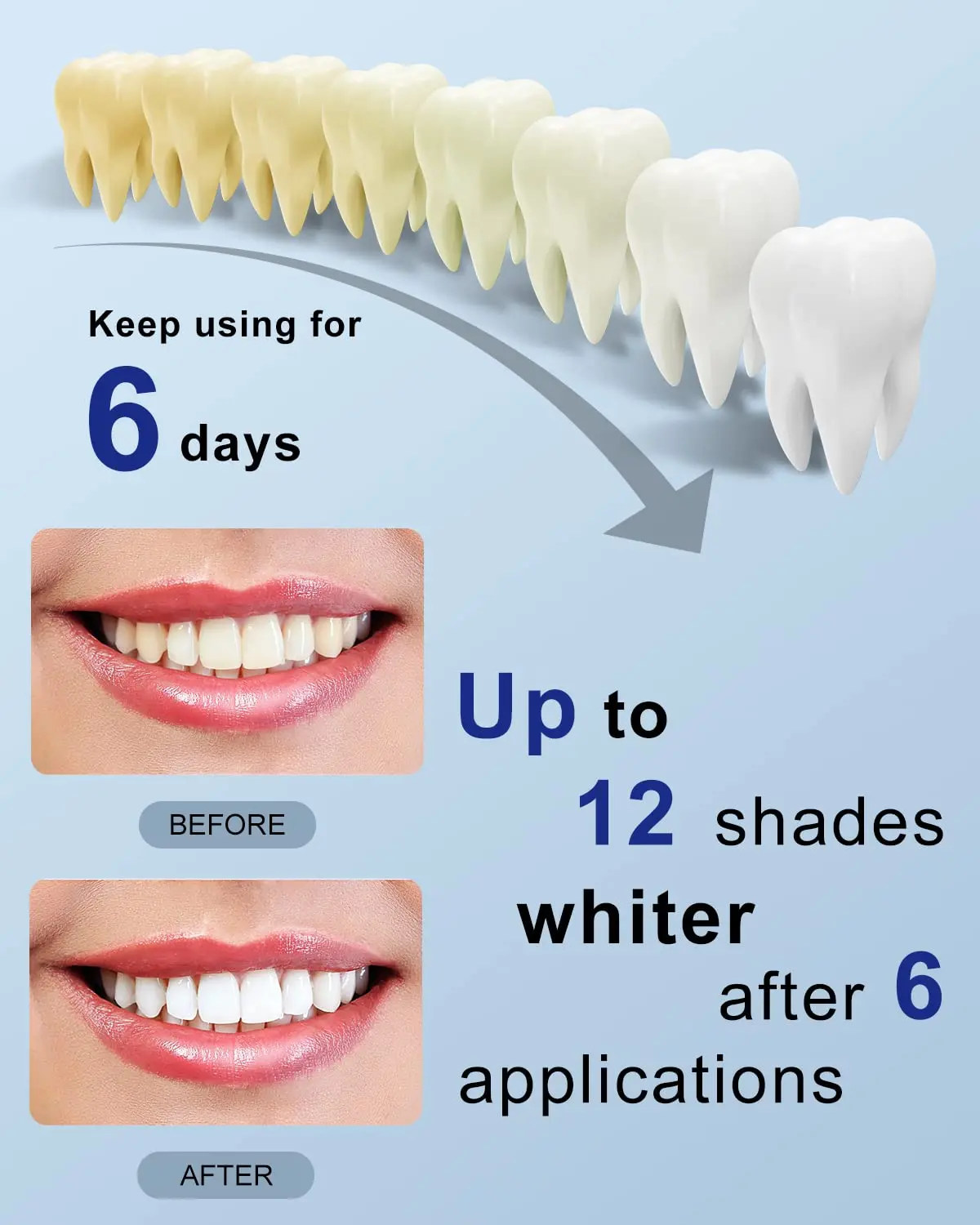 MySmile teeth whitening kit with LED light and whitening strips for sensitive teeth delivers a brighter, whiter smile in just 10 minutes at home or on the go.