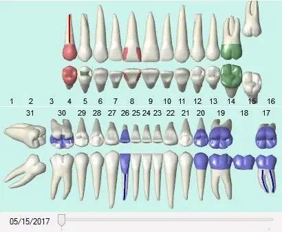 The waterproof ODI HD dental sensor size 2 with included software and TWAIN compliance connects via a 6.5-foot cable, allowing seamless integration with leading dental software.