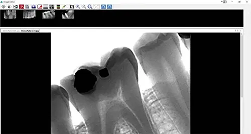 The waterproof ODI HD dental sensor size 2 with included software and TWAIN compliance connects via a 6.5-foot cable, allowing seamless integration with leading dental software.