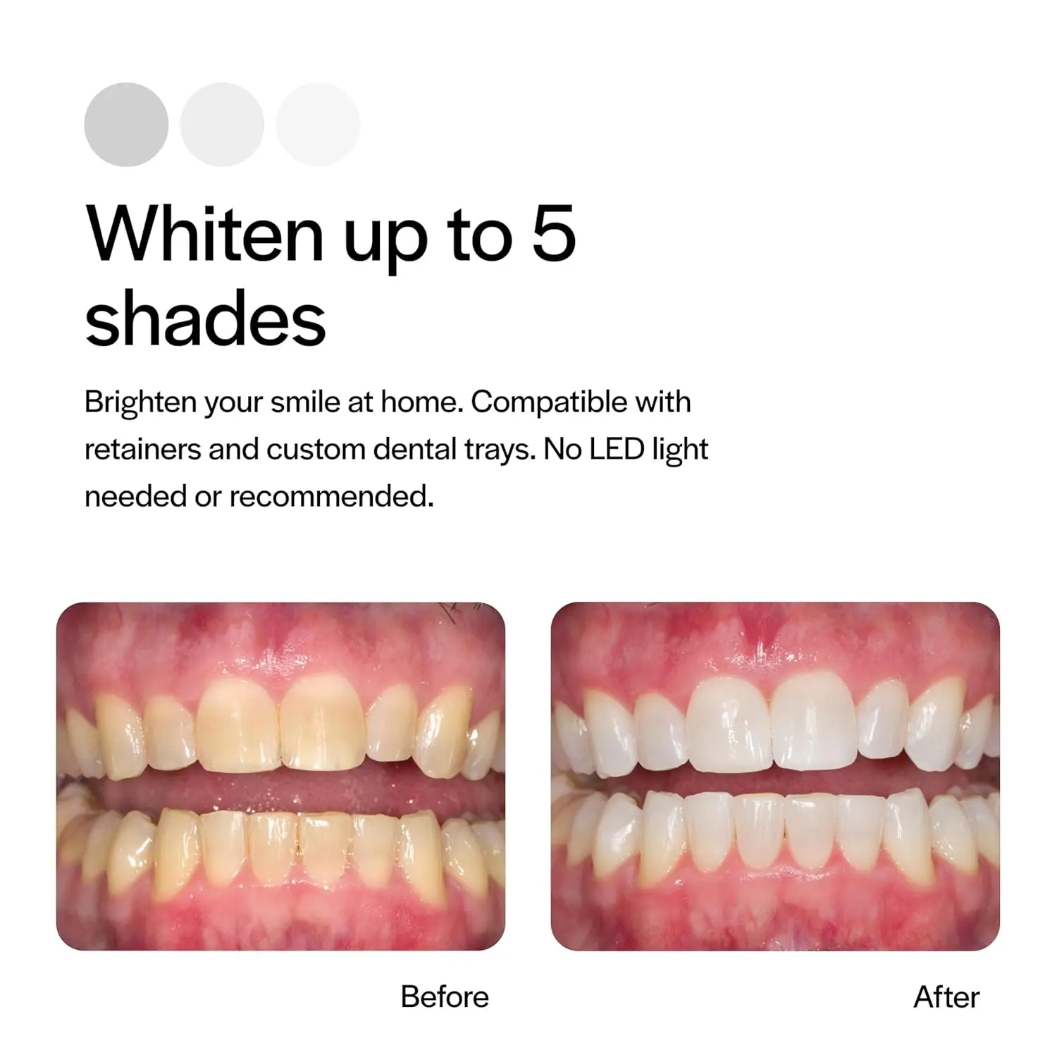 This image shows an Opalescence 20% PF Mint refill kit, a convenient and effective way to brighten your smile at home.