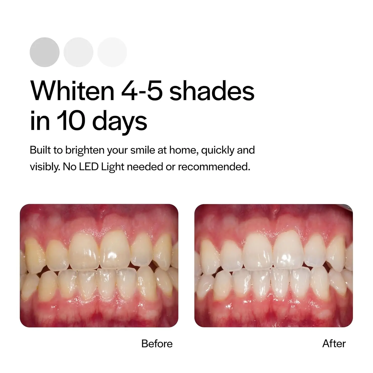 Opalescence Go 15% prefilled teeth whitening trays provide easy and effective at-home dental care for a brighter smile.