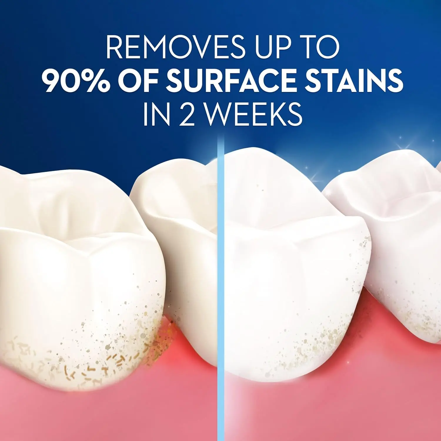 The Oral-B 3D White Luxe Pro-Flex medium toothbrush removes up to 90% of surface stains in two weeks with a stain eraser that polishes teeth.