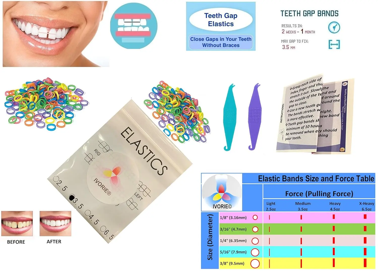 A pack of mixed color ortho elastic rubber bands for closing teeth gaps and other uses like braces and crafts.