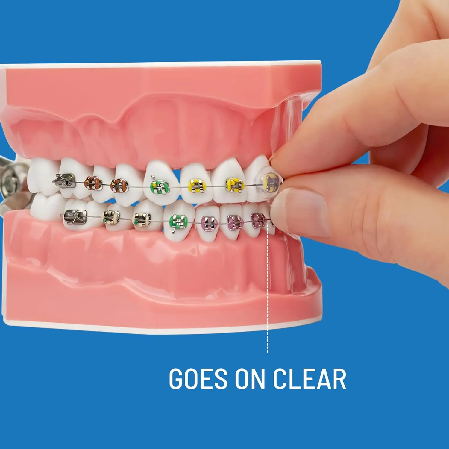 Orvance OrthoDots CLEAR offer pain relief from braces and aligners with a clear, moisture-activated formula that lasts up to 24 hours, providing a safer and more reliable alternative to traditional dental wax.