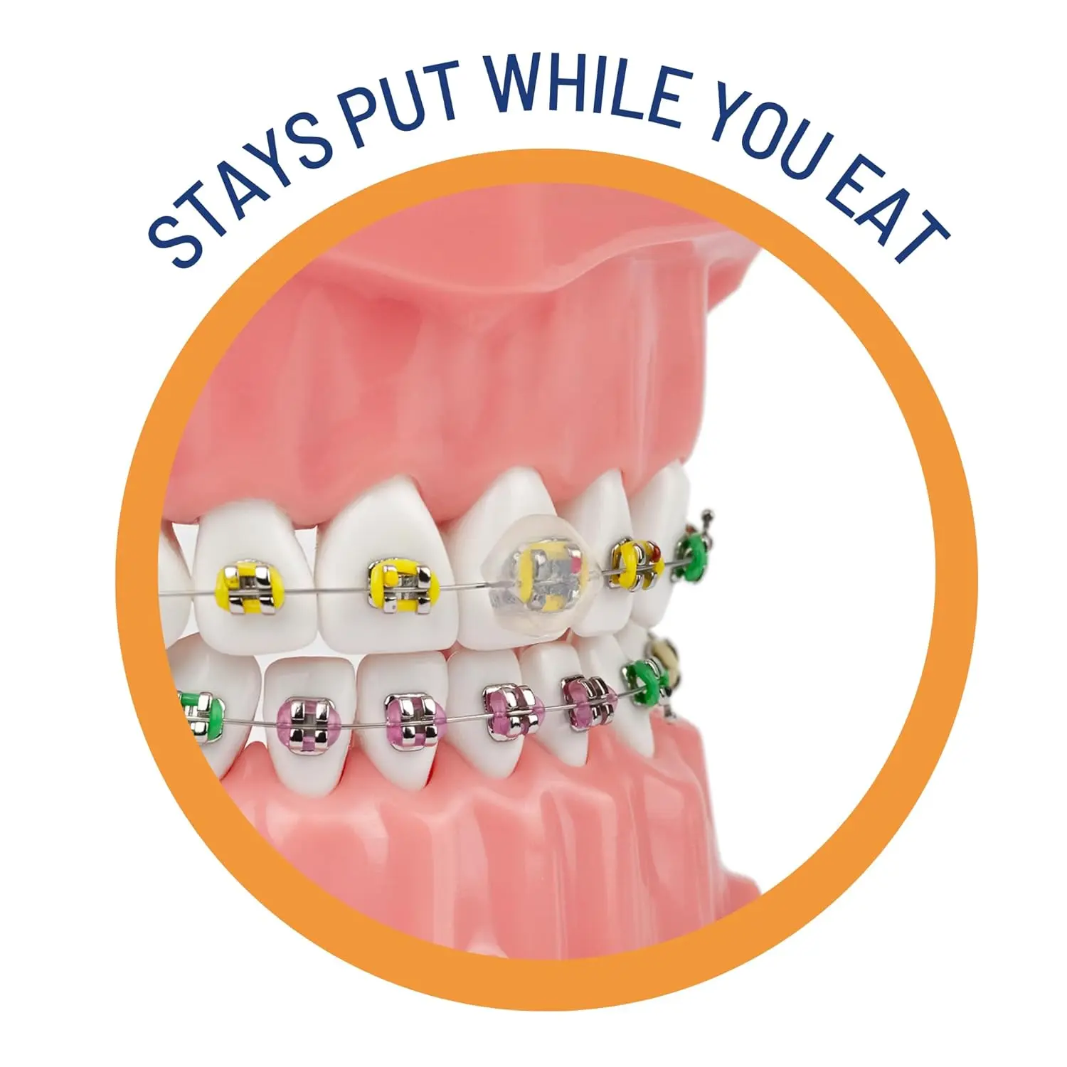 Orvance OrthoDots CLEAR offer pain relief from braces and aligners with a clear, moisture-activated formula that lasts up to 24 hours, providing a safer and more reliable alternative to traditional dental wax.