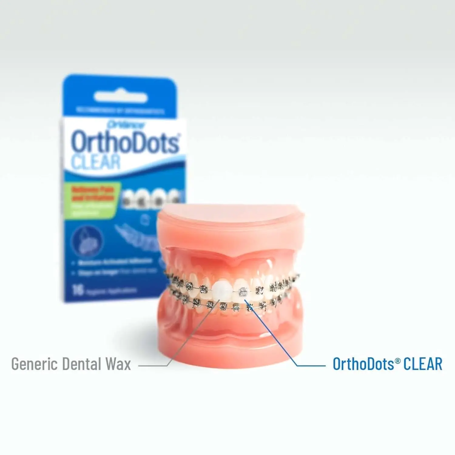 Orvance OrthoDots CLEAR offer pain relief from braces and aligners with a clear, moisture-activated formula that lasts up to 24 hours, providing a safer and more reliable alternative to traditional dental wax.