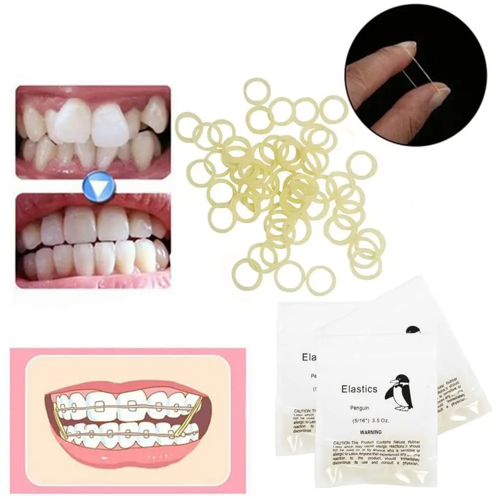 This pack contains 300 medium 3.5oz orthodontic elastic rubber bands, ideal for braces, gap closure, and even pet grooming or hair braiding.