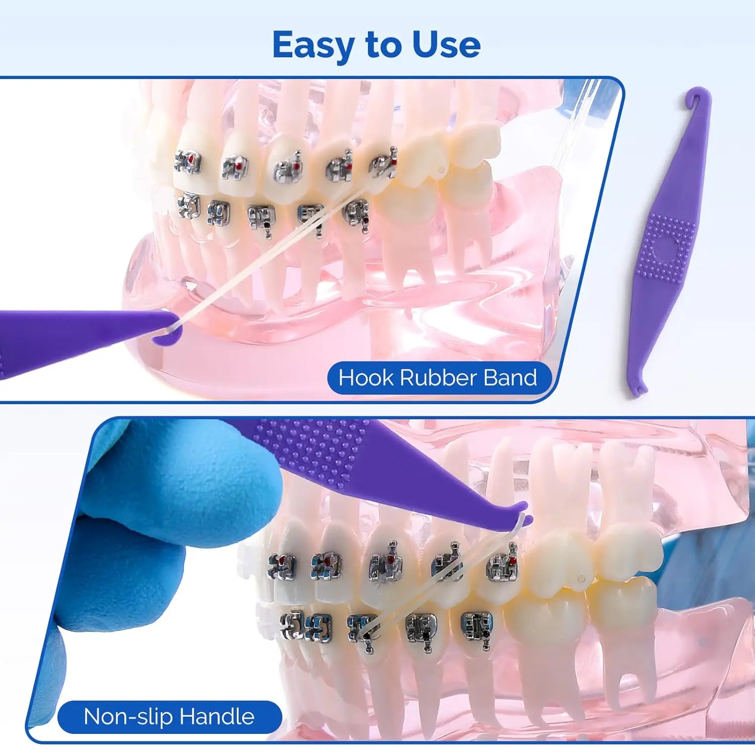This is a pack of 500 light, 1/8 inch intraoral orthodontic elastics made in the USA from high quality natural rubber, designed for closing gaps and orthodontics, and includes a free elastic placer.