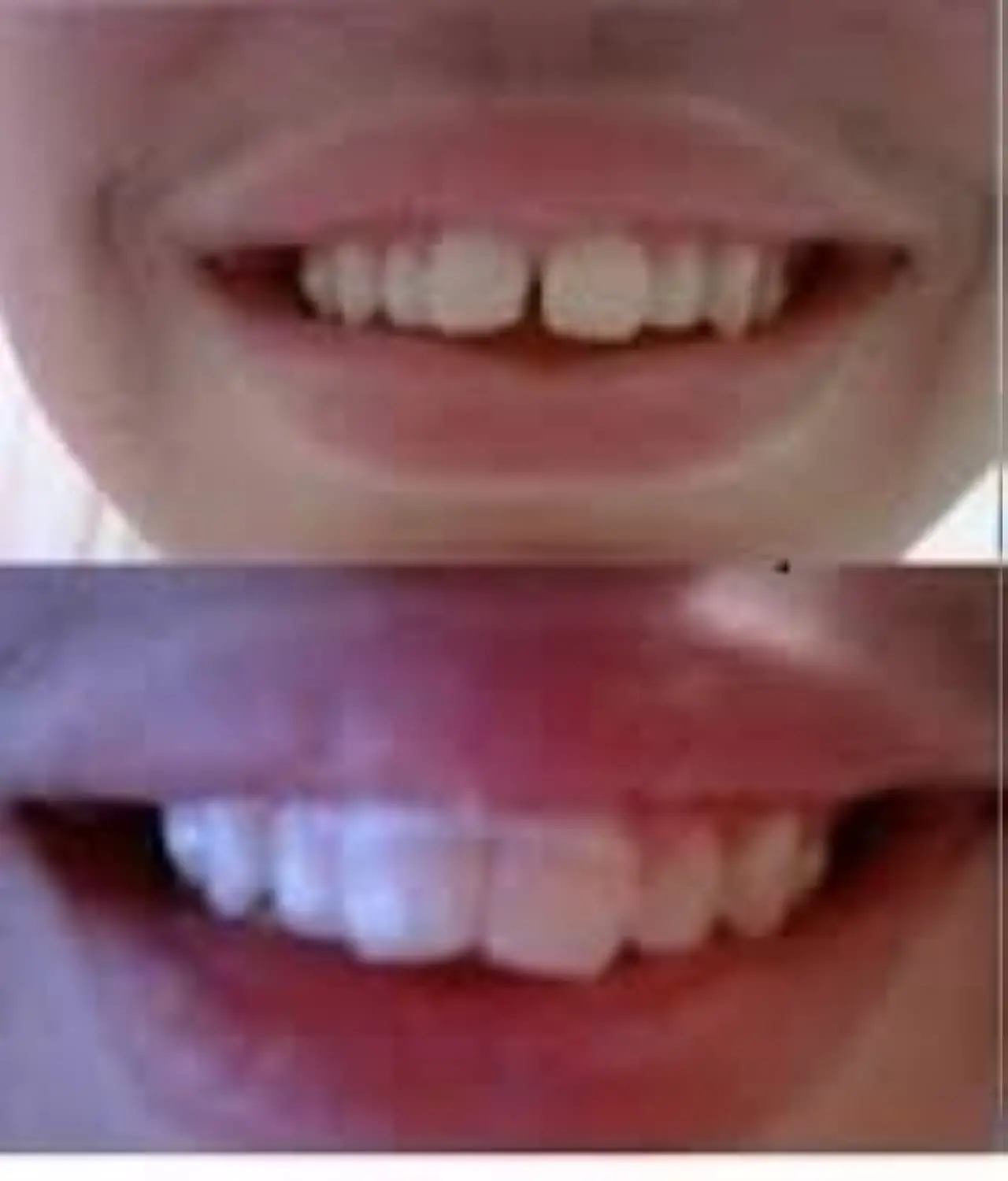 A pack of 100 super stretchy and durable orthodontic bands designed to close gaps between teeth.