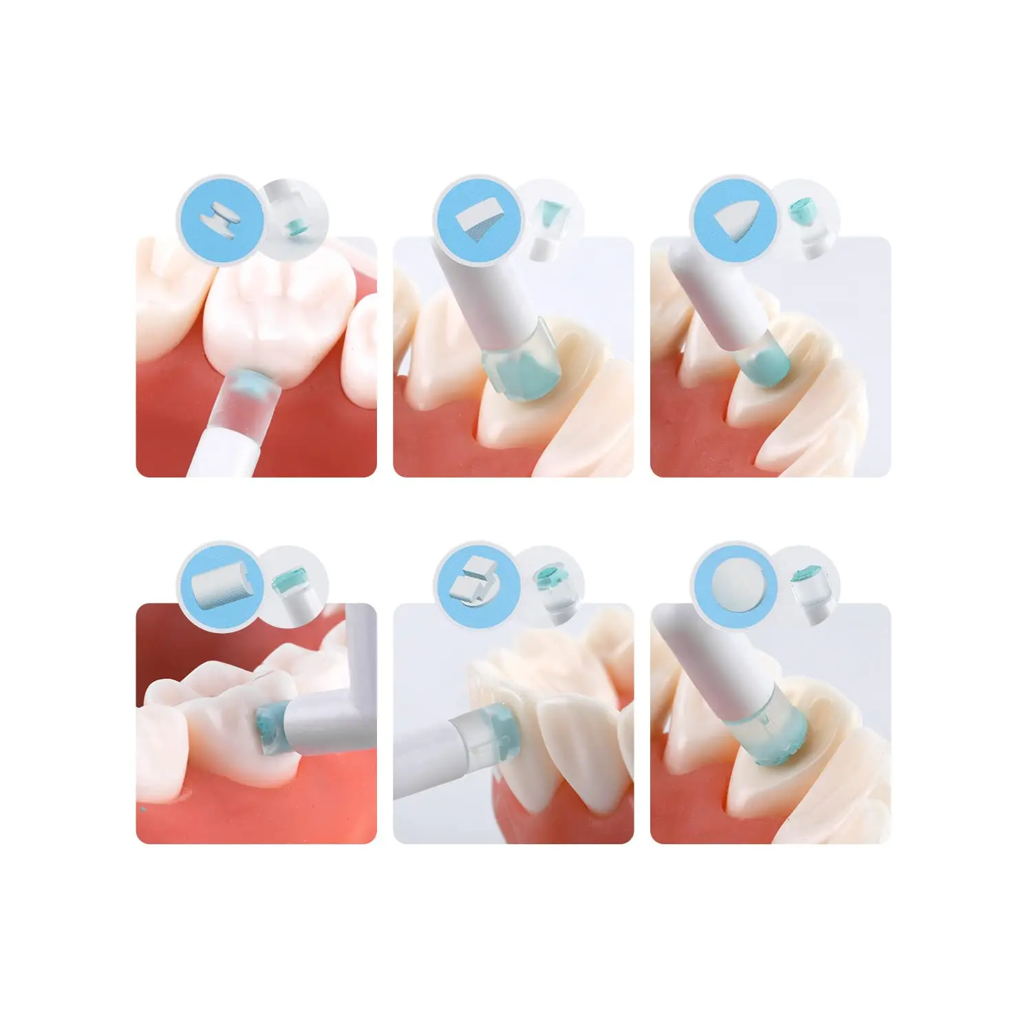 This orthodontic mold kit contains six different high quality molds for quickly creating aesthetic accessories like tubes and lingual retention buttons in just three easy steps, recommended by dentists.
