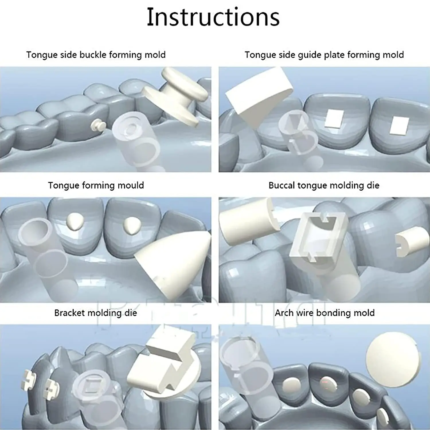 This orthodontic mold kit contains six different high quality molds for quickly creating aesthetic accessories like tubes and lingual retention buttons in just three easy steps, recommended by dentists.