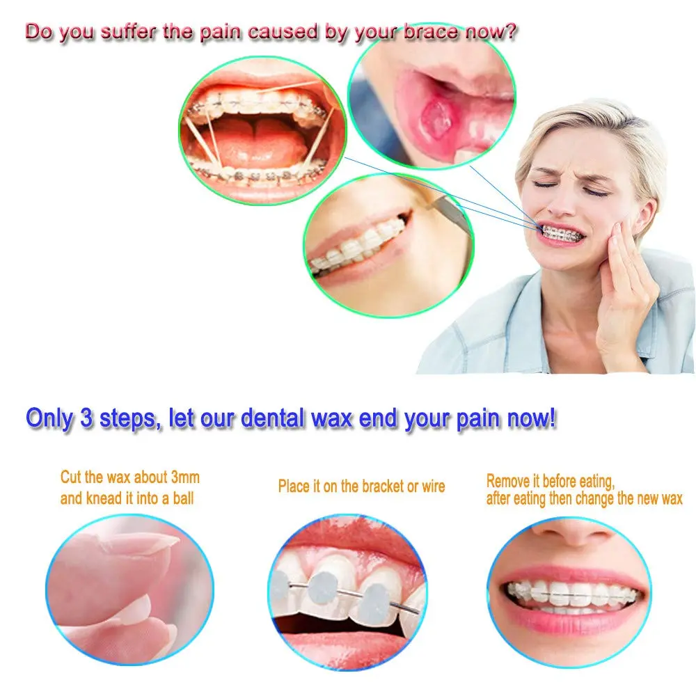 Ten boxes of Gewene dental orthodontic wax in mint flavor for braces wearers to protect gums from irritation.