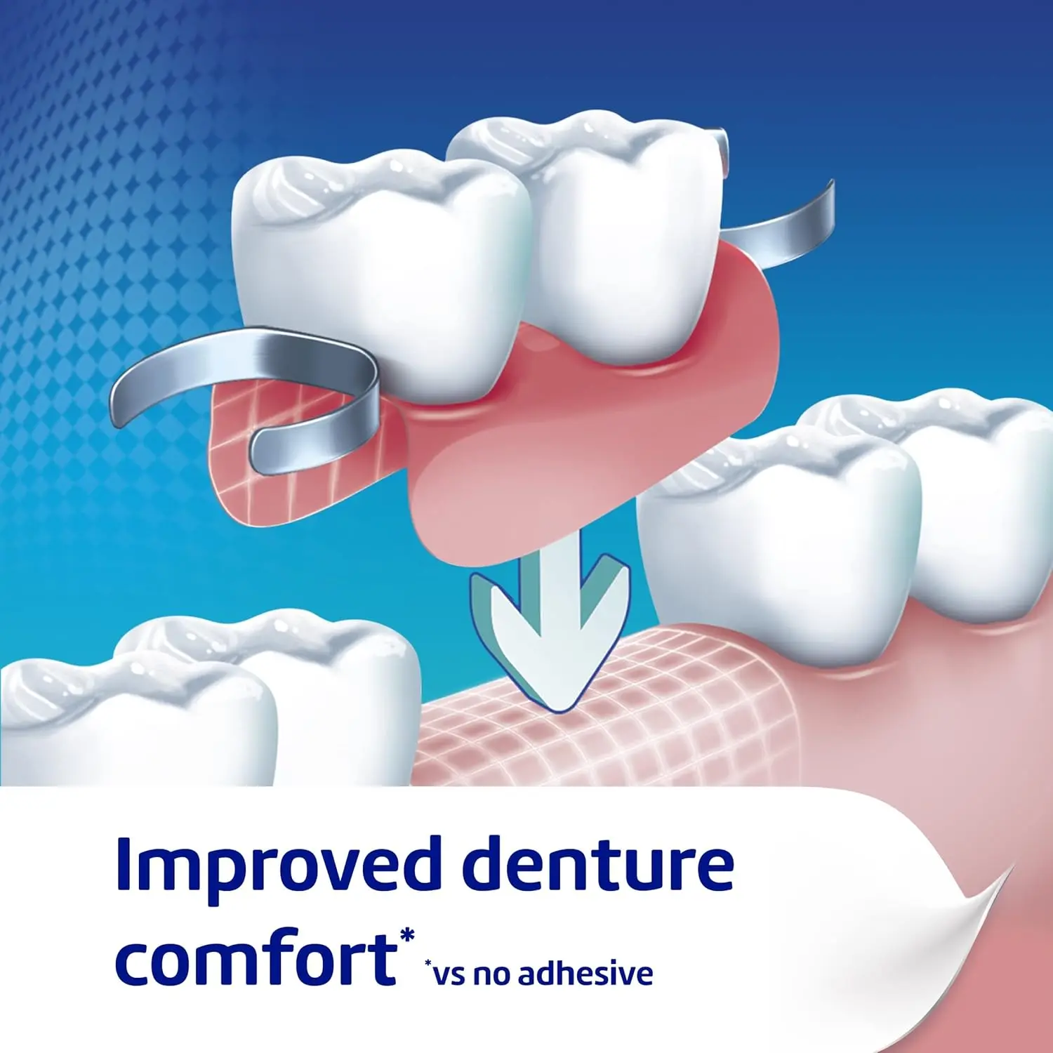 Poligrip flavor-free denture adhesive provides a strong, all-day hold for full and partial dentures, sealing out food particles and ensuring comfortable, confident wear.