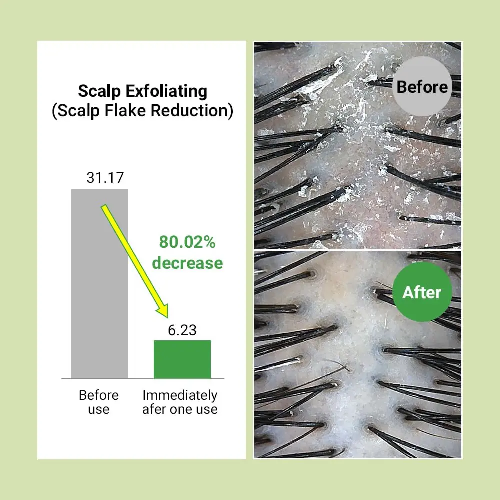 RATED GREEN Real Mary Exfoliating Scalp Shampoo with organic shea butter and lily extract for shiny, soft hair, 400ml.