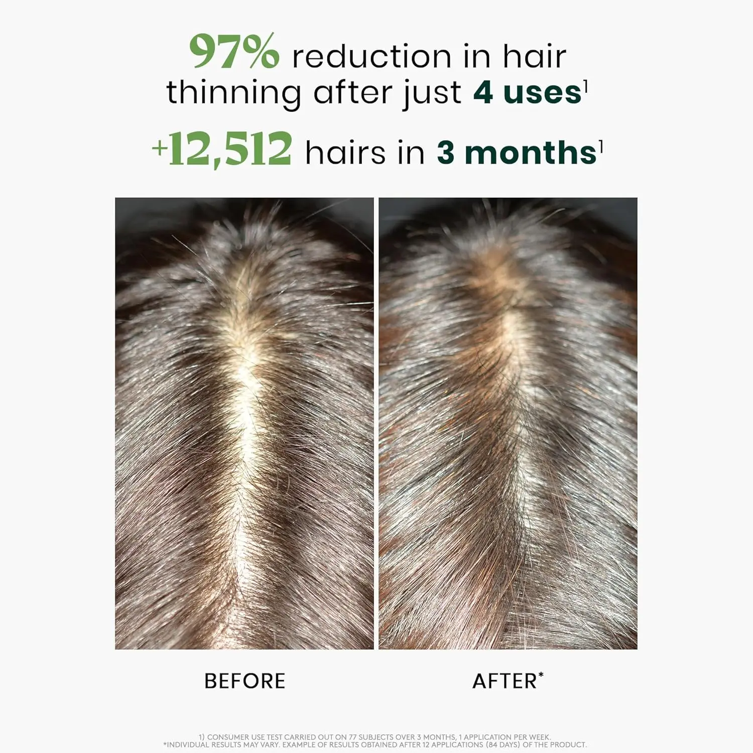 Rene Furterer Triphasic Reactional Anti Hair Loss Treatment for sudden hair loss, containing 12 vials.