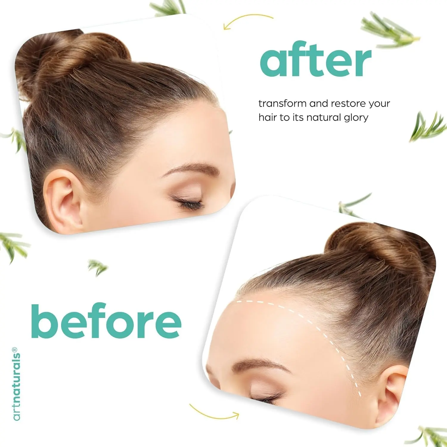 Artnaturals rosemary castor hair oil with coconut and olive oil promotes hair growth, strengthens hair, and moisturizes the scalp for healthier, shinier hair.