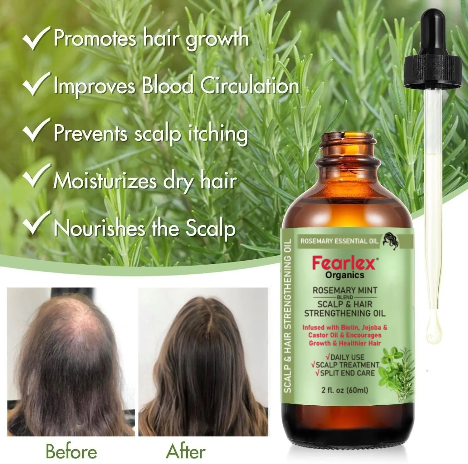 Fearlex rosemary mint hair oil infused with biotin promotes healthy hair growth, strengthens hair, and nourishes the scalp with natural organic ingredients.
