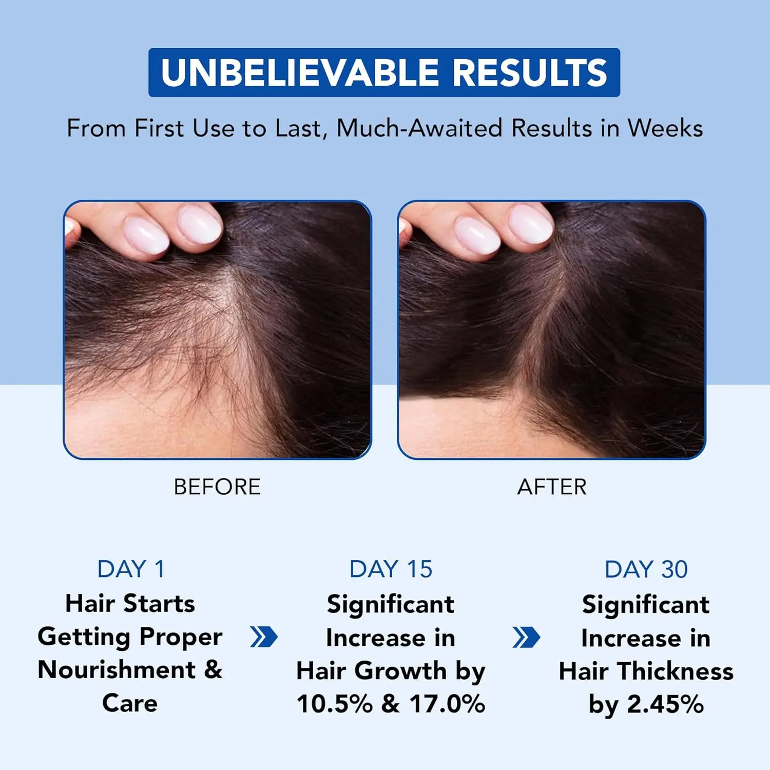 Botanic Hearth rosemary oil for hair promotes hair growth, strengthens hair follicles, and reduces dandruff with biotin, jojoba, and castor oil.