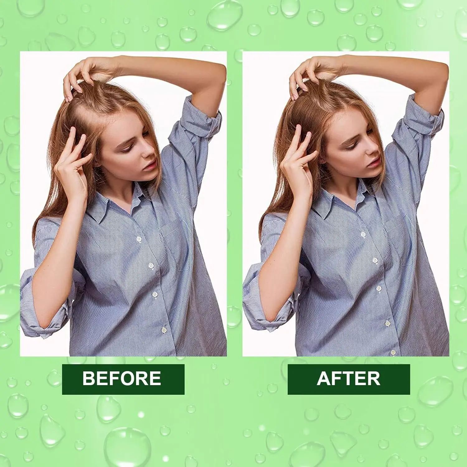 A bottle of ALIVER rosemary oil serum promotes hair growth, nourishes the scalp, and repairs dry, damaged hair with its pure and natural formula.