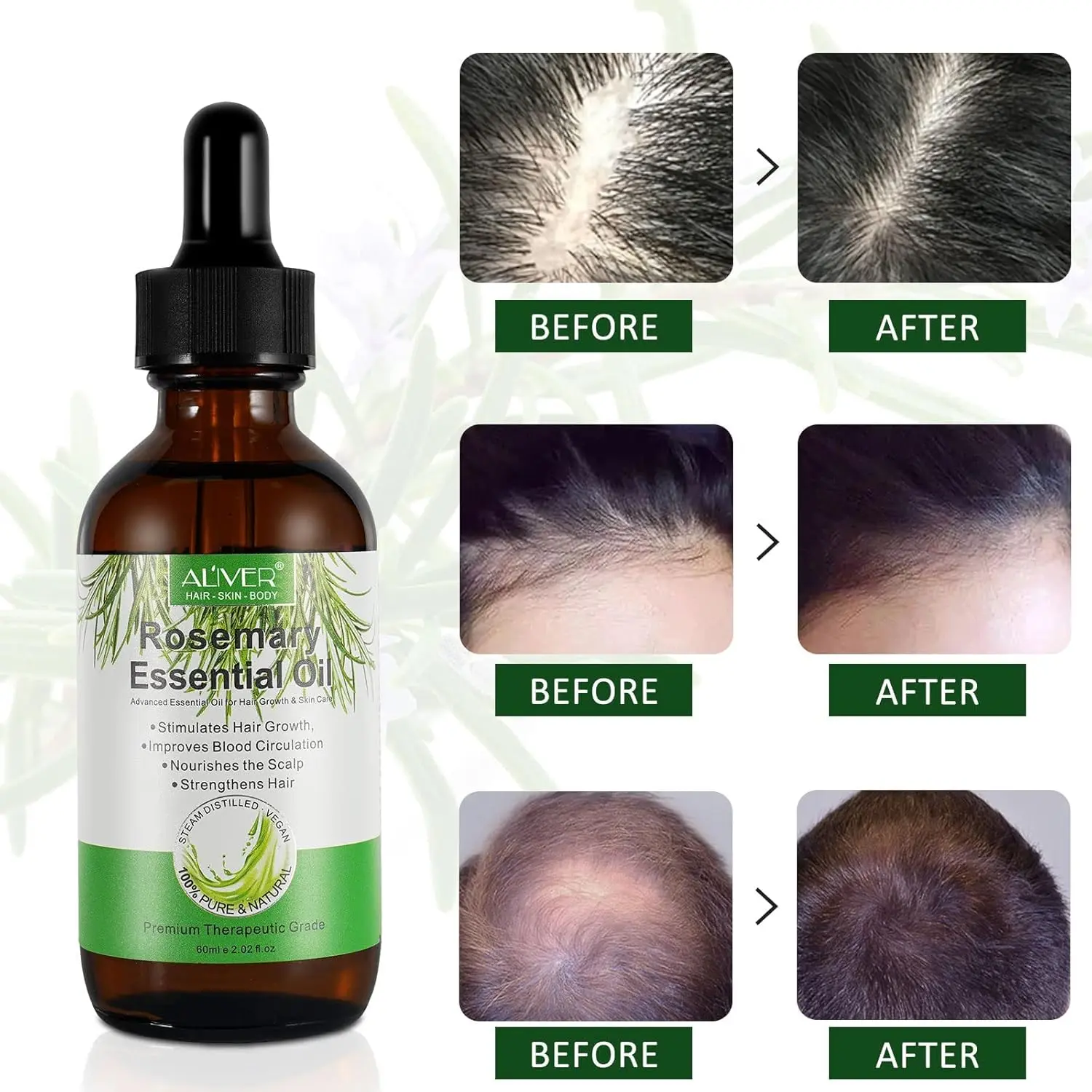 A bottle of ALIVER rosemary oil serum promotes hair growth, nourishes the scalp, and repairs dry, damaged hair with its pure and natural formula.