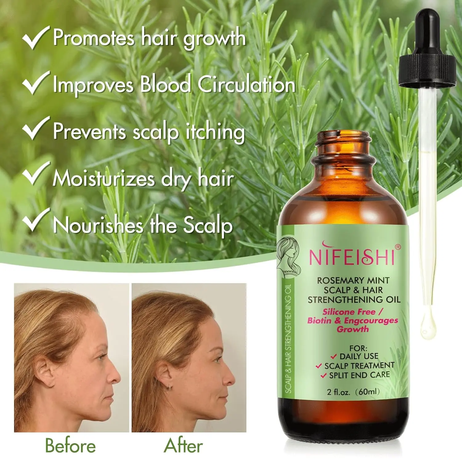 This bottle of rosemary oil with biotin is an organic essential oil serum that helps stimulate hair follicles, prevent hair loss, repair damaged hair, moisturize dry scalp, and promote hair growth.