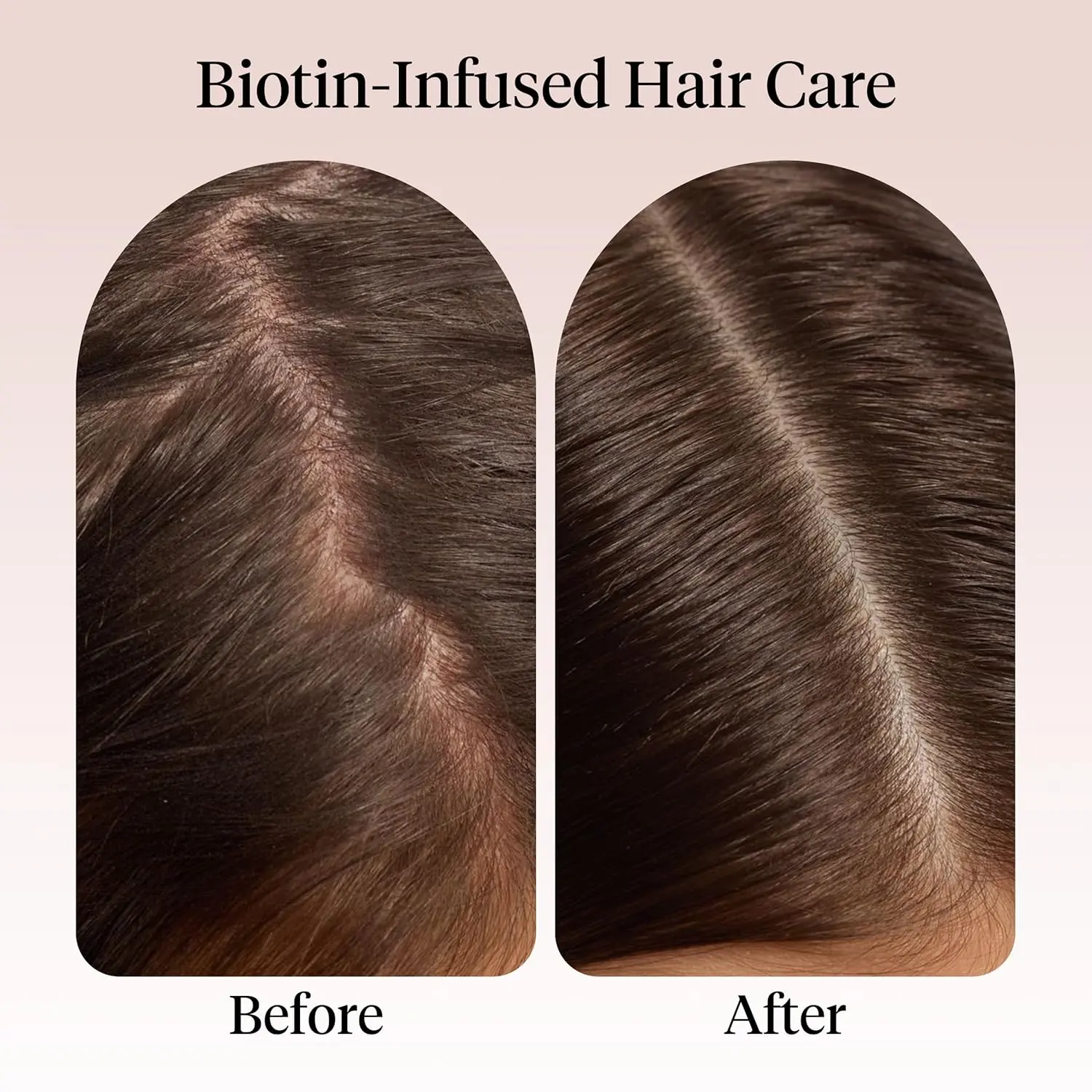 Kitsch rosemary oil serum nourishes the scalp and supports healthy hair growth with biotin and a blend of argan, jojoba, and castor oils in eco-friendly packaging.