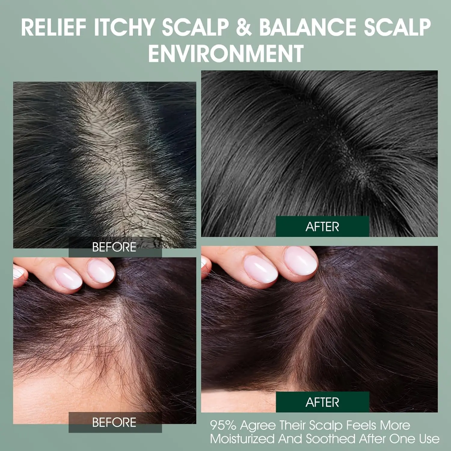 This rosemary and tea tree scalp treatment detoxifies and clarifies build-up, leaving your dry, itchy scalp feeling refreshed.