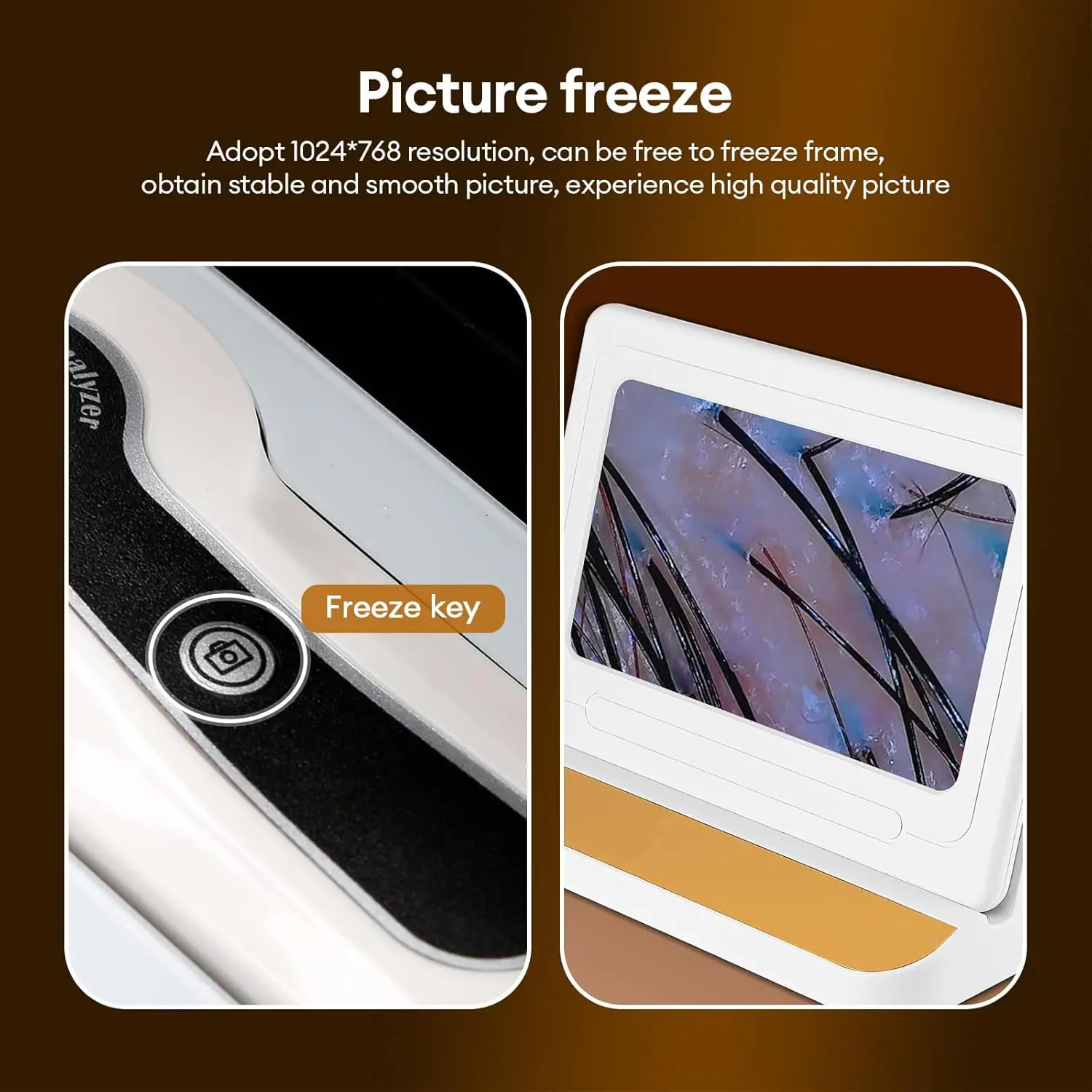 This is a professional-grade hair and skin analyzer with a large 11-inch HD screen and 50x/200x magnification lenses, ideal for detailed scalp and follicle analysis at home or in a salon.