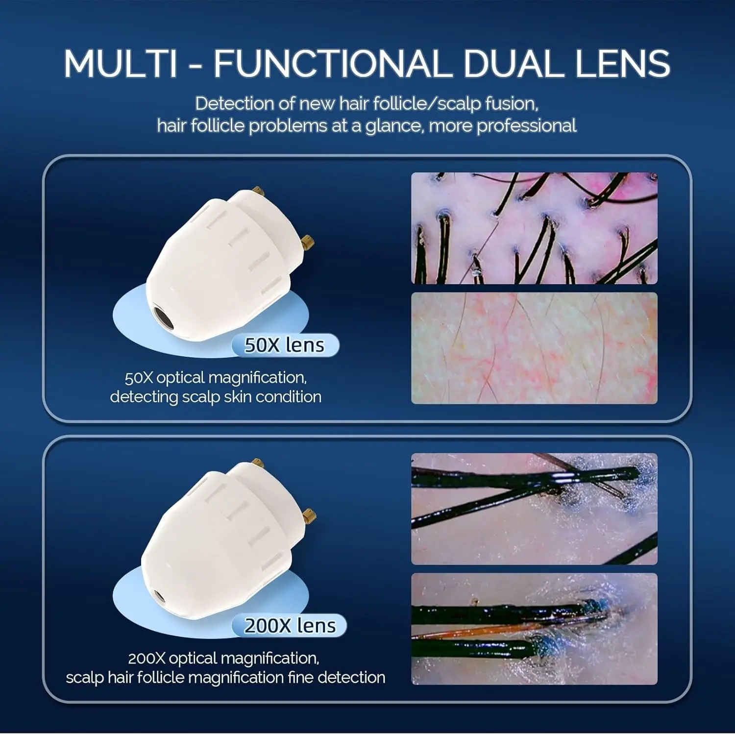 This is a professional-grade hair and skin analyzer with a large 11-inch HD screen and 50x/200x magnification lenses, ideal for detailed scalp and follicle analysis at home or in a salon.
